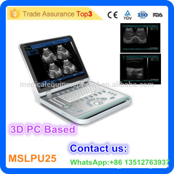 MSLPU25-I 2016 Lastest 3d portable abdominal ultrasound/Pc base ultrasound scanner